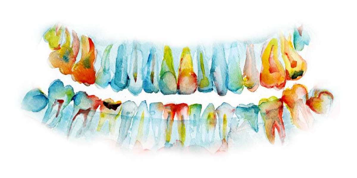 Classification of Dental Crowns: A Prosthodontist's Perspective