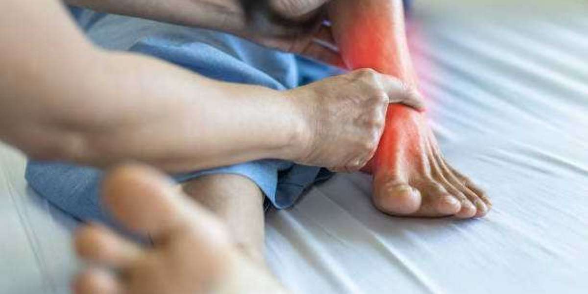 Controlling Neuropathy: Effective Methods for Relieving Nerve Pain